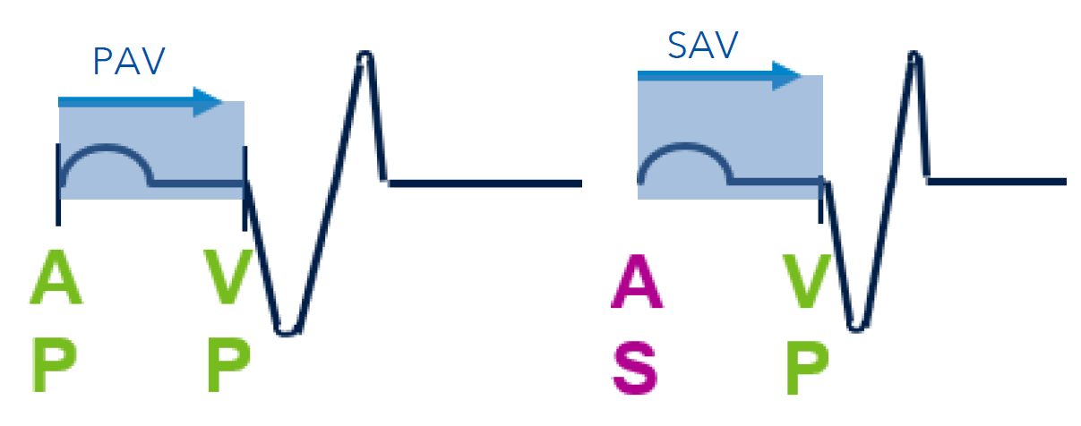 <p>1) Paced AV Delay (PAV): This interval begins with a paced atrial event (AP)</p><p>2) Sensed AV Delay (SAV): This interval begins with a sensed atrial event (AS)</p>