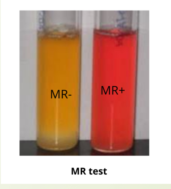 <p>How do you know if MR is positive? </p>