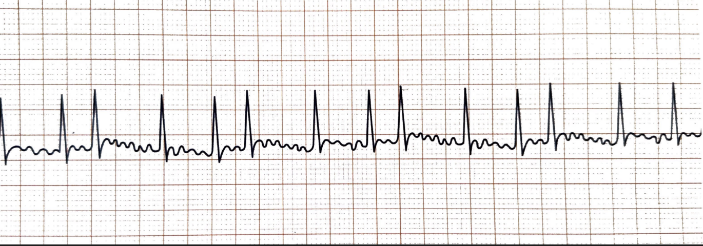 <p>What rhythm is this + bpm</p>