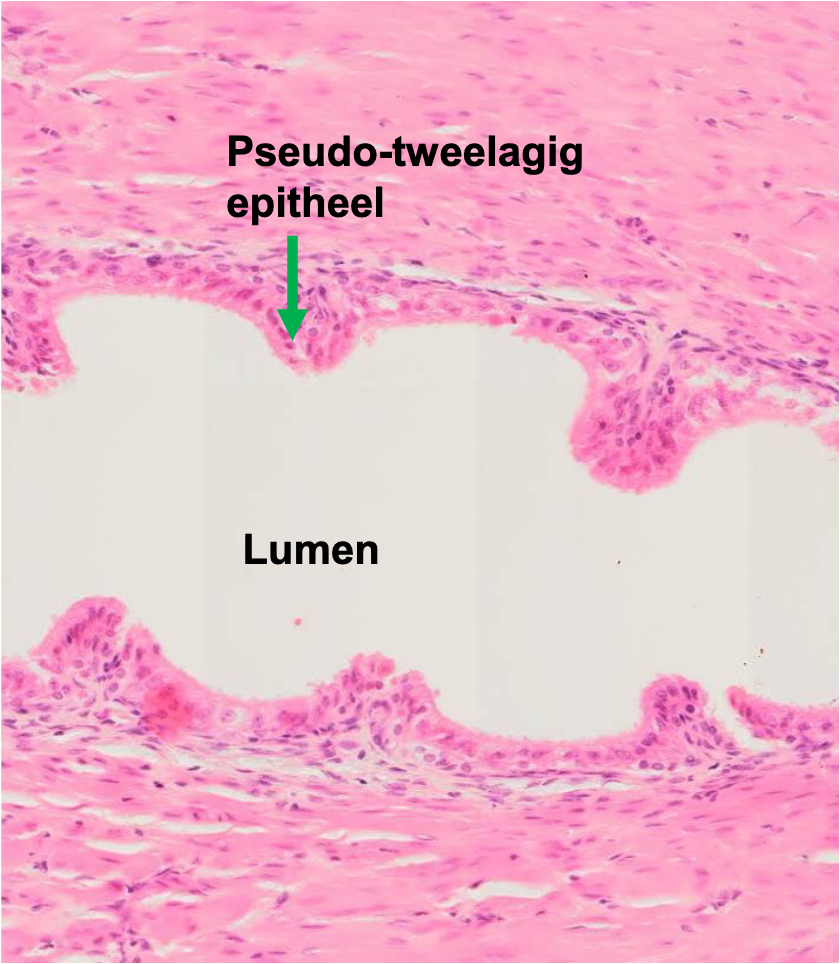<p>de wand van de ductus deferens</p>