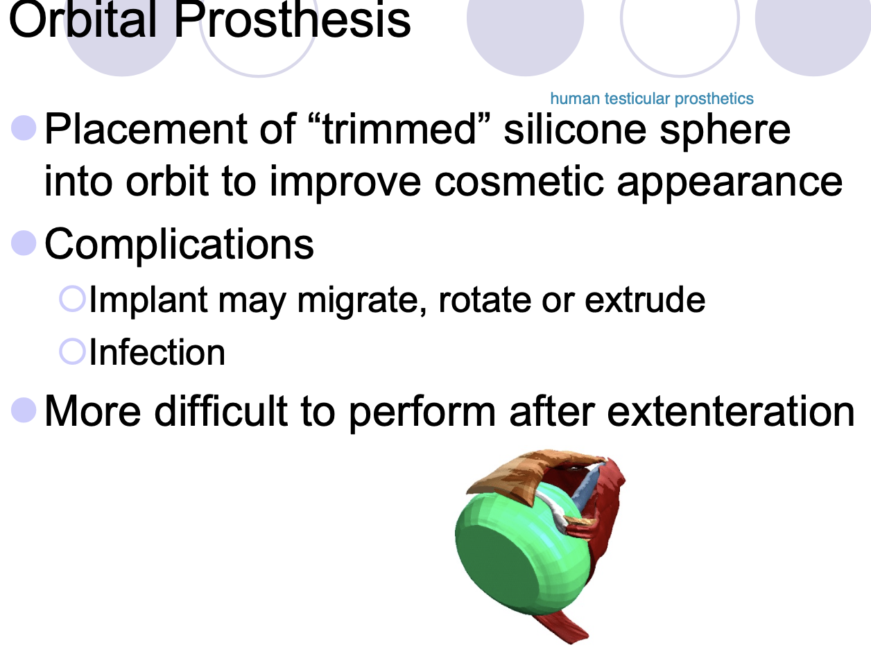 <p>trimmed silicone sphere into orbit to improve cosmetic appearance.</p><p>More difficult to perform after exenteration.</p>