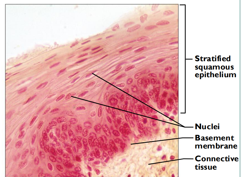 <ul><li><p>multiple layers </p></li><li><p>cells cuboidal or columnar </p></li><li><p>thick membrane</p></li></ul><p></p>
