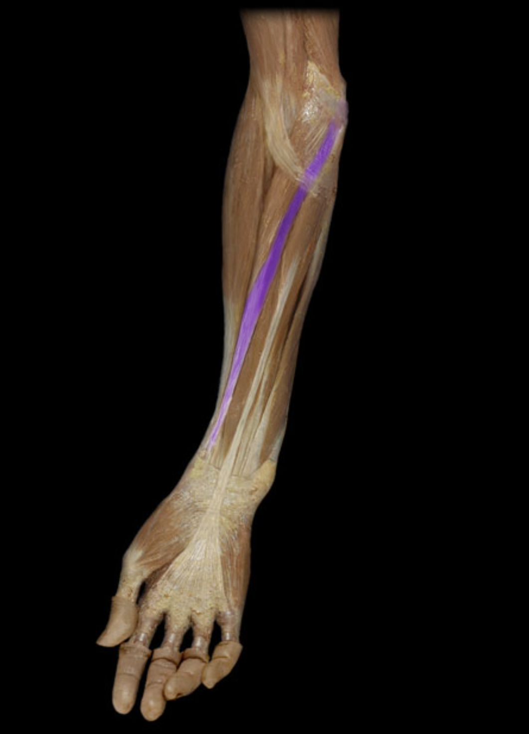 <p>What muscle is highlighted?</p>
