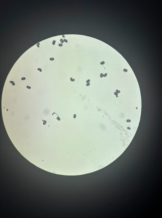 <ul><li><p><strong>Haploid (n)</strong></p></li><li><p><strong>Male gametophyte</strong></p></li><li><p>Carried by wind</p></li><li><p>Produces <strong>sperm nuclei</strong> (no swimming required)</p></li></ul><p></p>