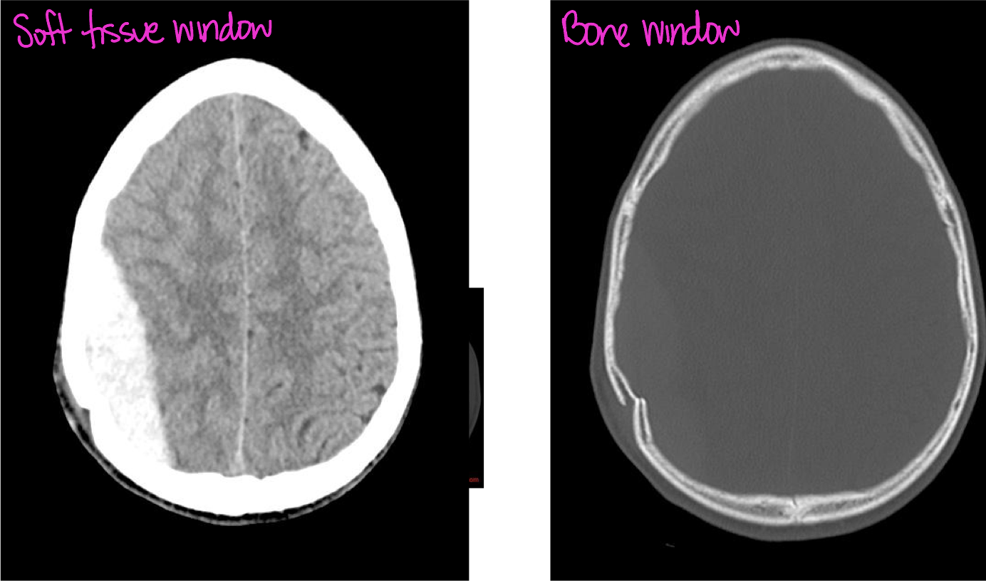 <p>CT</p>