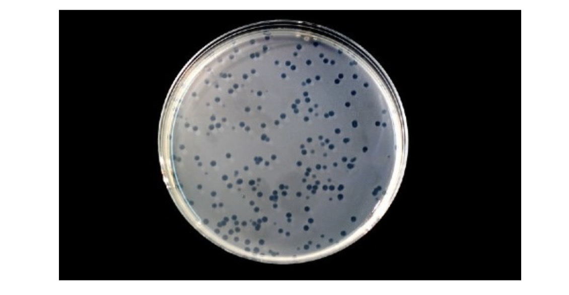 <p>A. What do the holes in the lawn called? </p><p>B. What can cause the holes? </p><p>C. What bacteria is most likely used here? </p><p>D. What type of media is used here? </p>