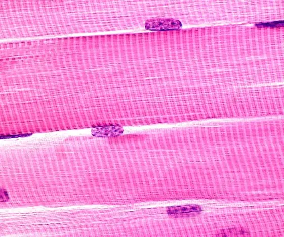 <p>striated muscle fibres</p>