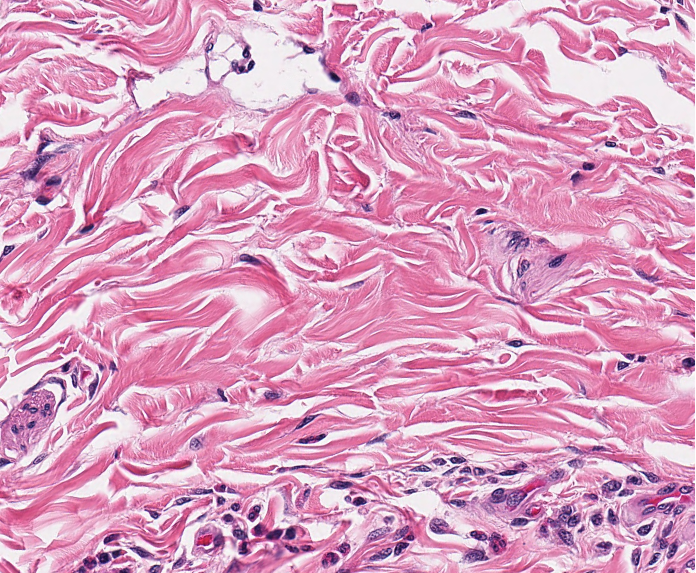 <p><span style="font-family: "Calibri Light";">Which type of CT is this?</span></p>
