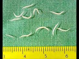<p>Pinworms</p>