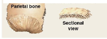 <p>Thin, parallel surfaces that provide protection and muscle attachment. <em>Ex:</em> Roof of skull (parietal bone), sternum, ribs, and scapula</p>