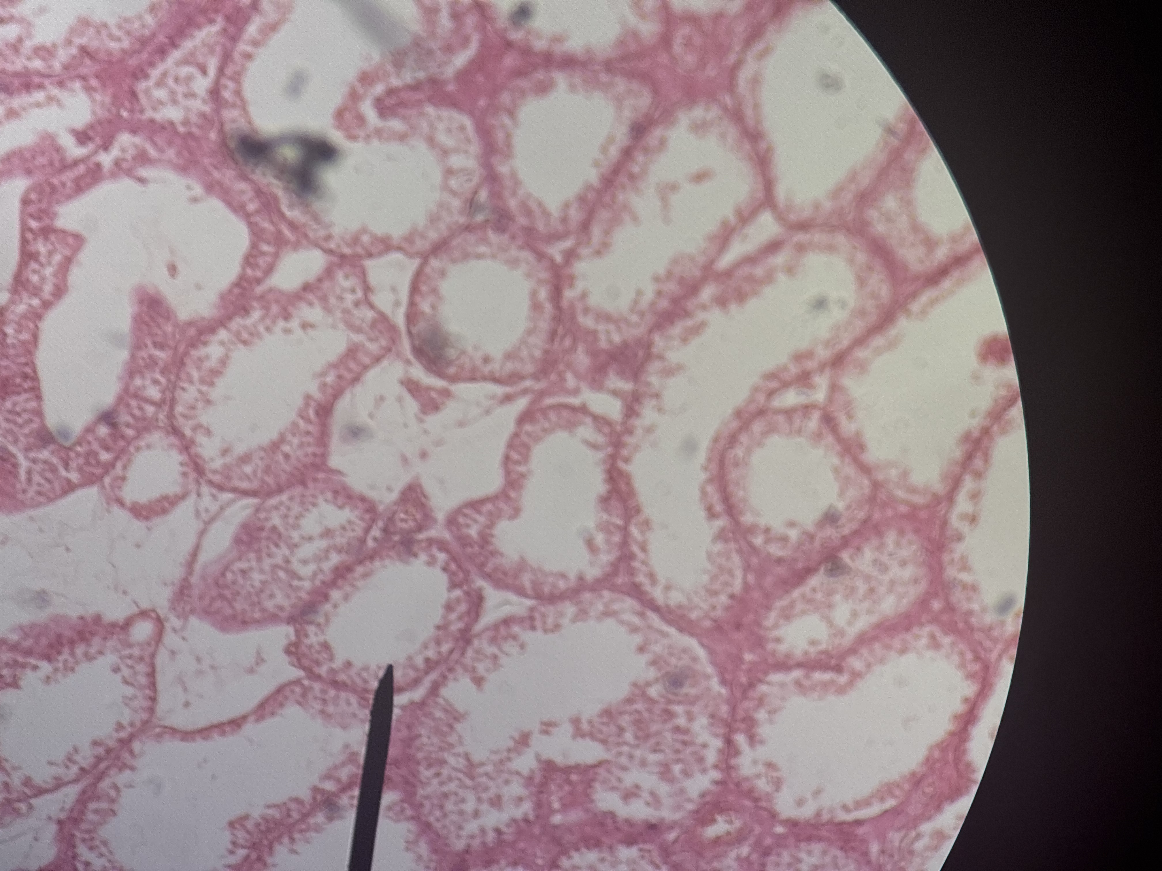 <p><strong>seminiferous epithelium</strong></p>