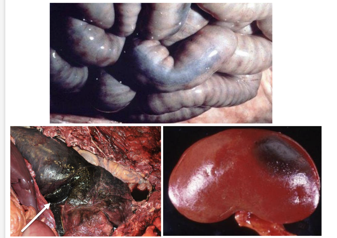 <p>what is Pseudomelanosis </p>