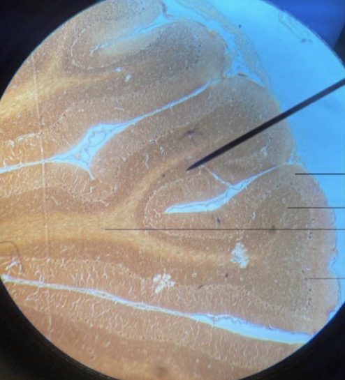 <p>what type of tissue?</p>