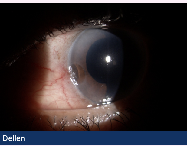 <p>Describe and what’s the diagnosis?</p>