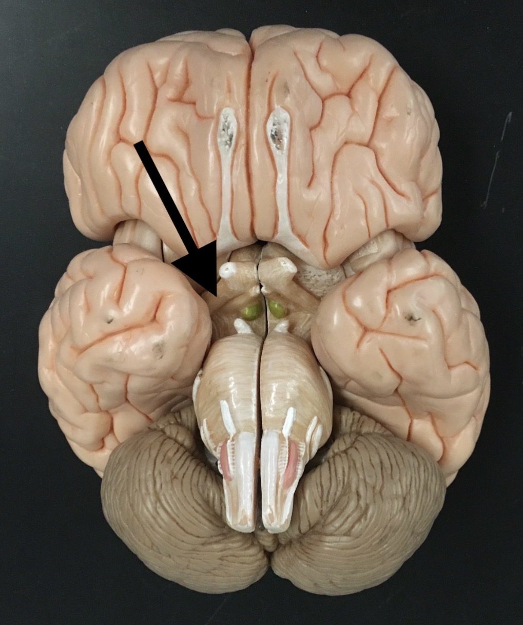 <p>What is the arrow pointing to?</p>