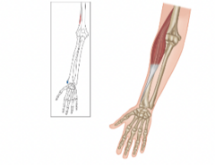 <p>What muscle is highlighted?</p>