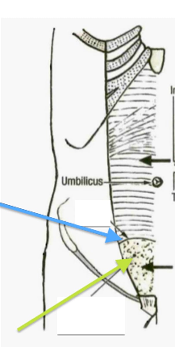 <p>structure of the rectus sheath below the umbilicus - represents movement of the rectus sheath to invest certain muscles above it and certain muscles below it</p>