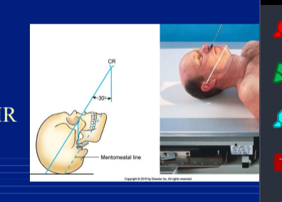 <p>supine </p><p>OML 37deg to IR</p><p>MML almost perp </p>