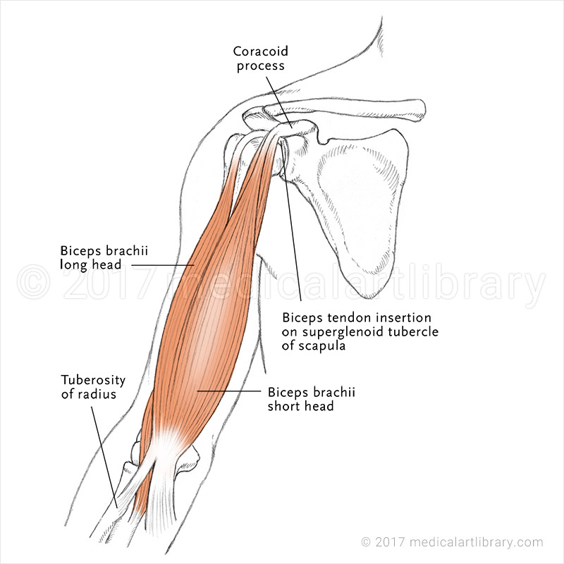 <p>Biceps Brachii (LH)</p>