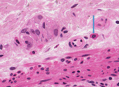 <p>Identify the connective tissue cell?</p>