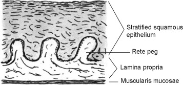 <p>Epithelium in mucosa of esophagus</p>