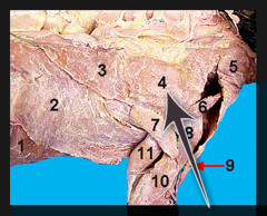 <p>muscle that works together with the spinotrapezius to hold the scapulae together</p>