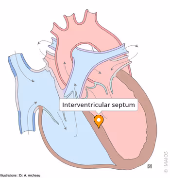 <p>interventricular septum</p>