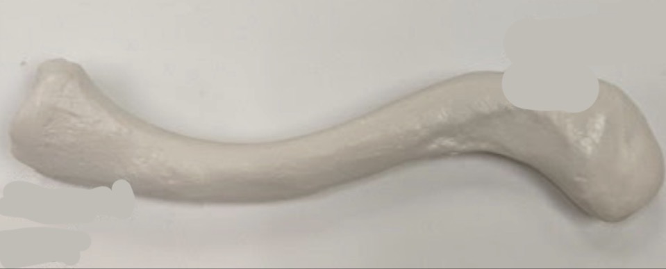 <p>What bone is this? </p>