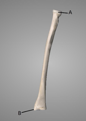 <p>A</p>