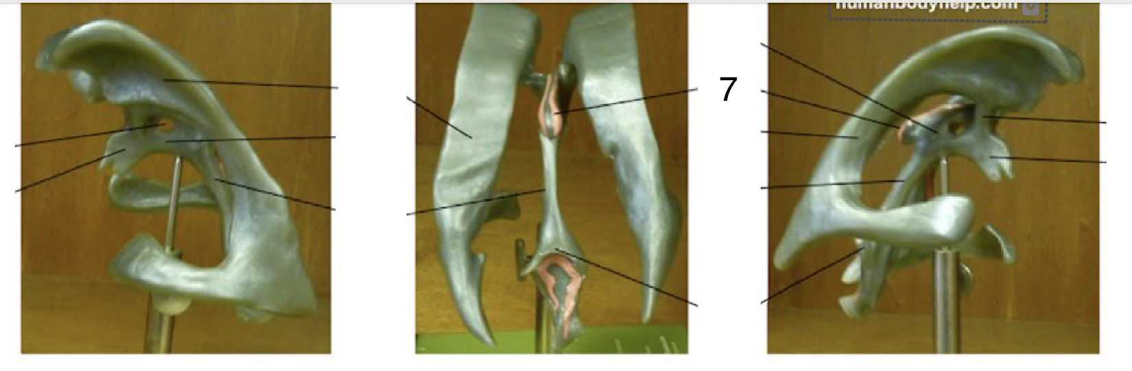 <p><strong>Location: Pink/red areas; Function: Produce CSF (cerebrospinal fluid)</strong></p>