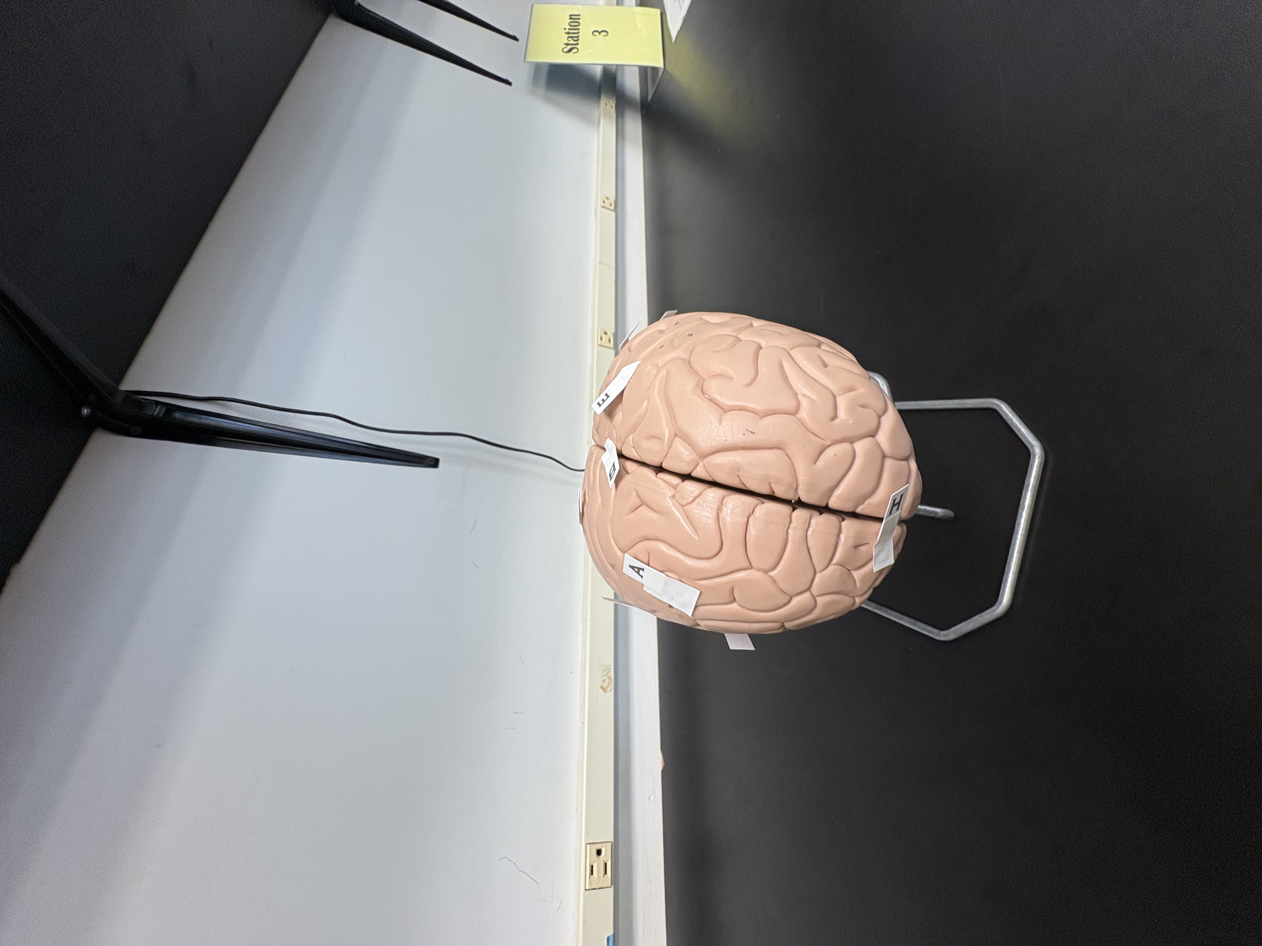 <p>H. identify this lobe of the brain</p>