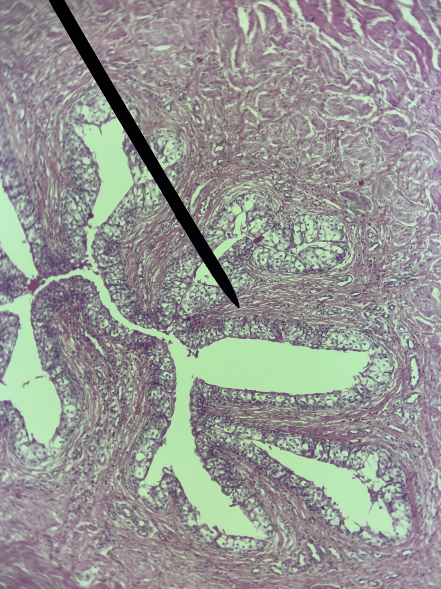 term image