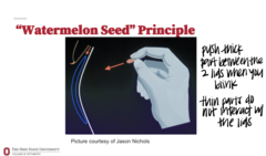 <p>What is the "Watermelon Seed Principle" of CLs rotation & eyelid interaction?</p>