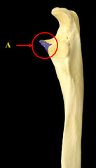 <p>beak-like anterior process</p>