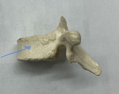 <p>What is the arrow pointing to?</p>