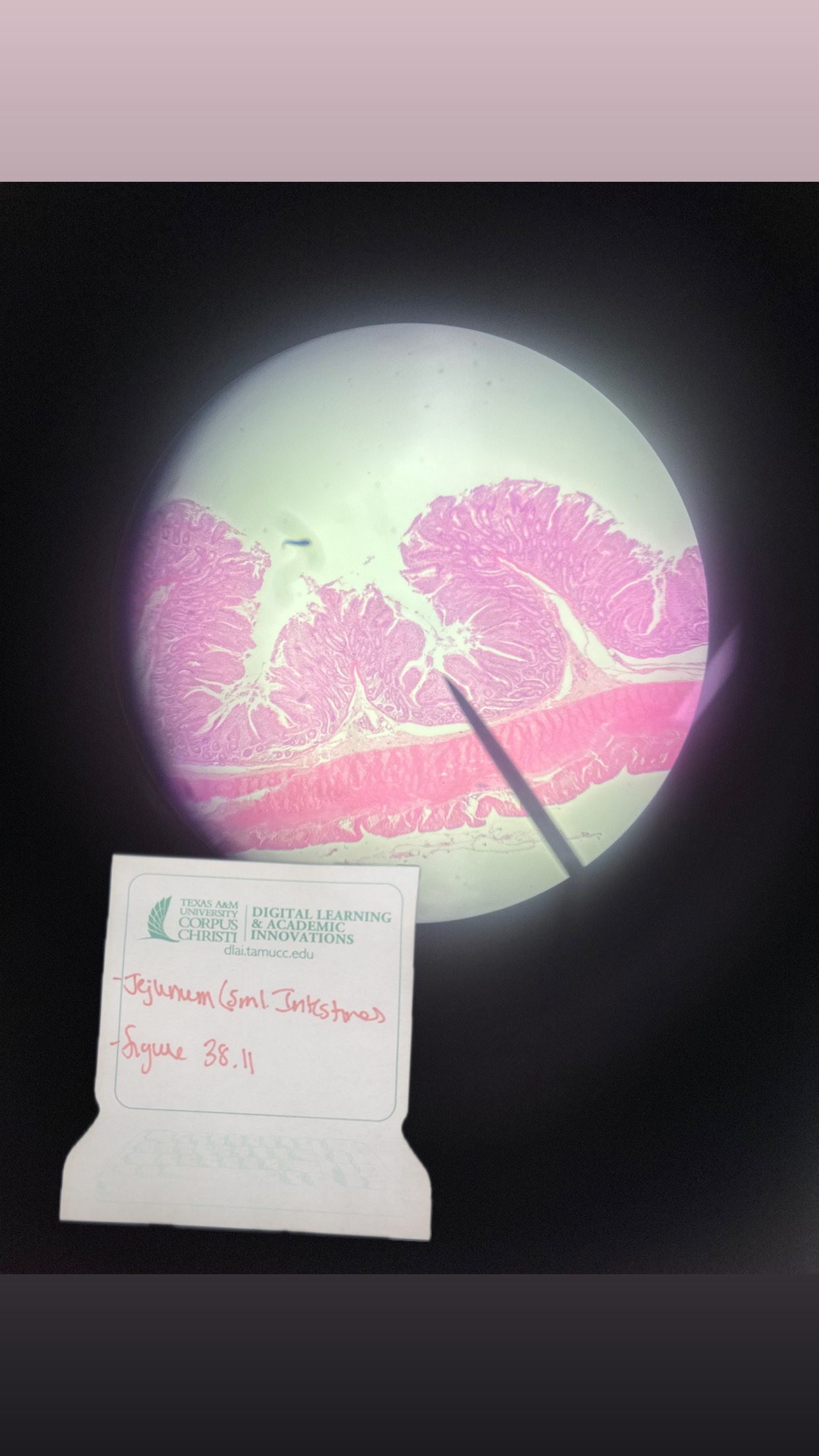 <p>JEJUNUM</p>
