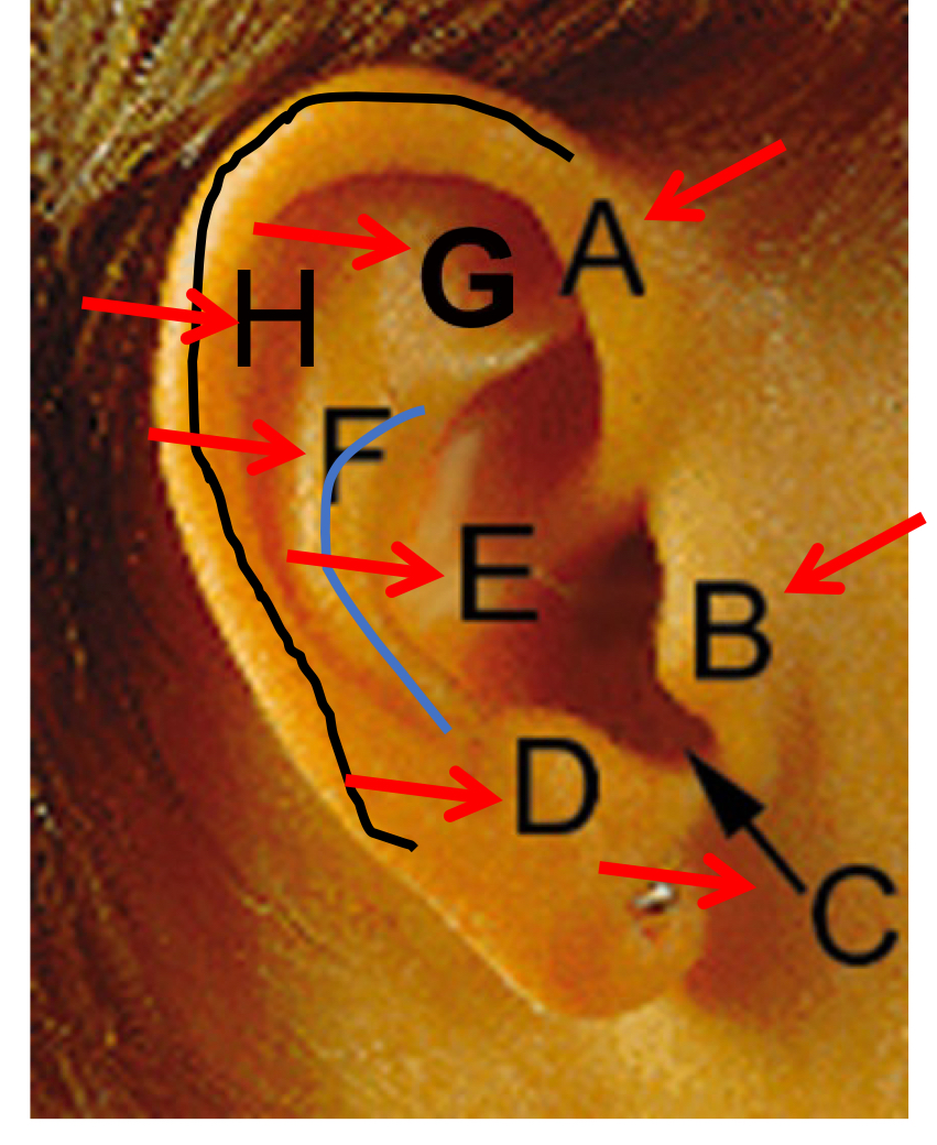 <p>A</p>