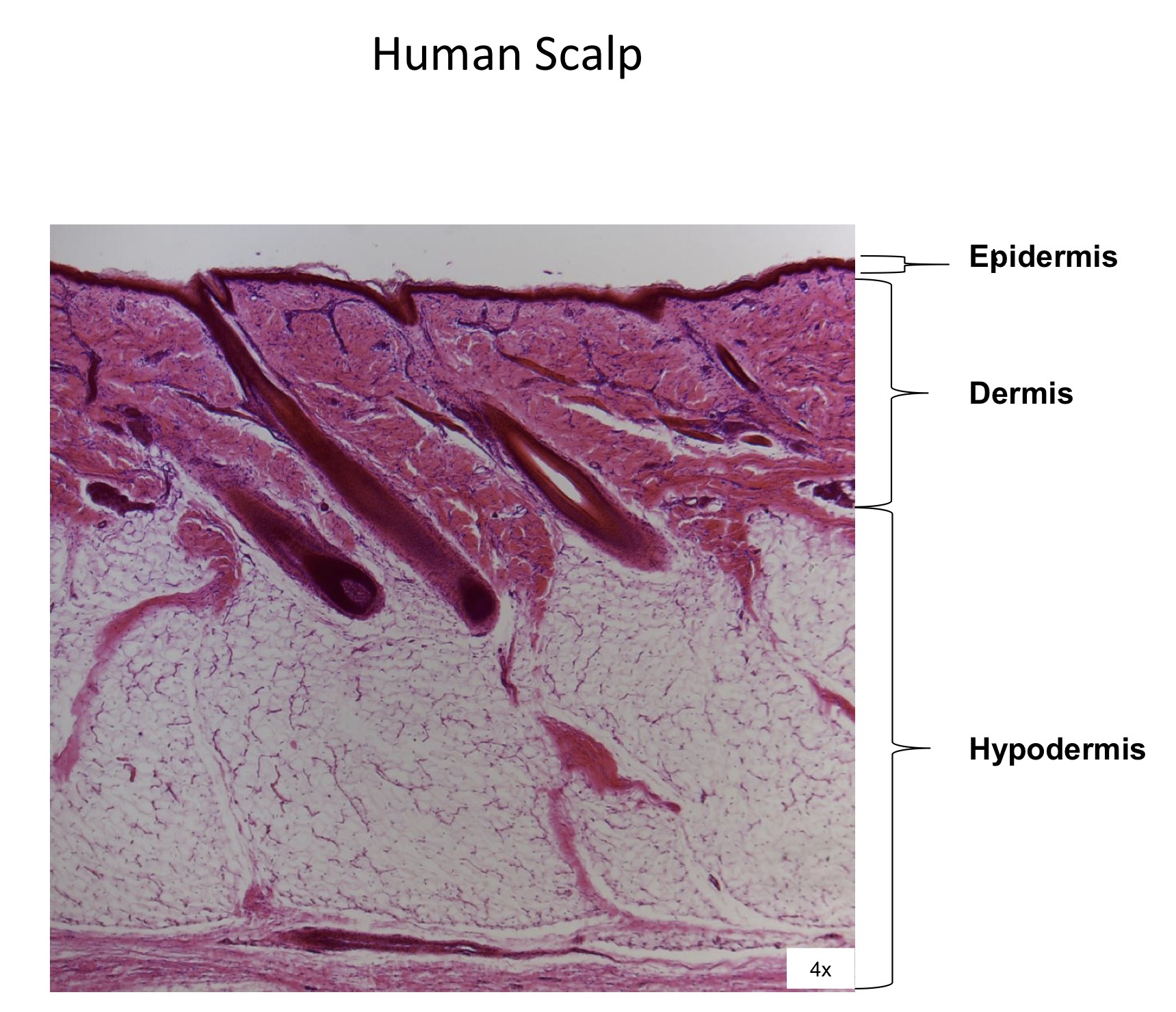 <ol><li><p>Epidermis </p></li><li><p>Dermis</p></li><li><p>Hypodermis </p></li></ol><p></p>