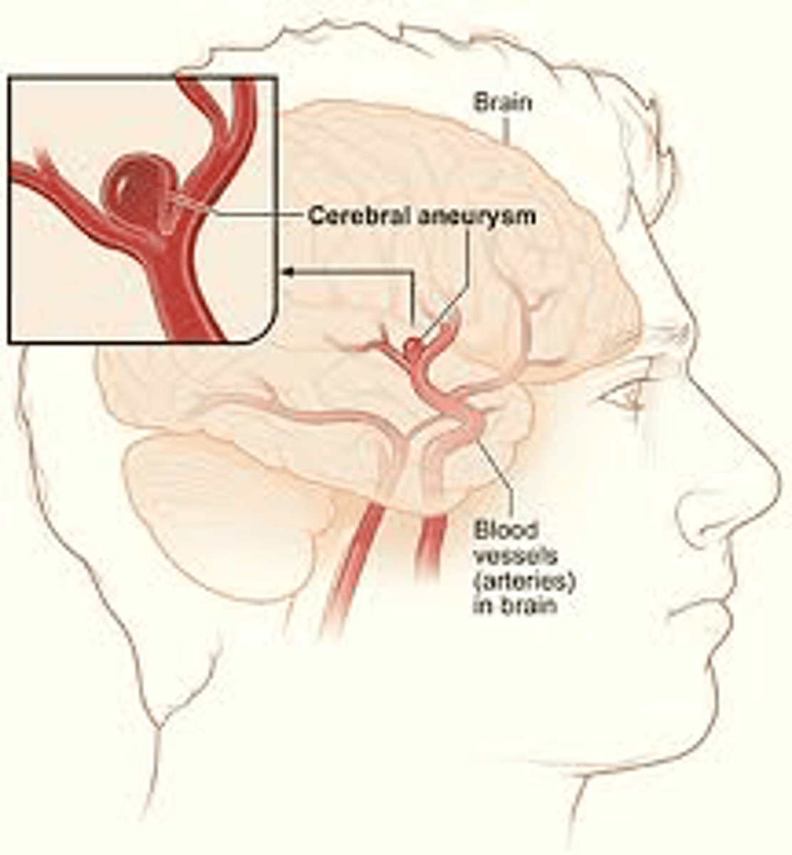 <p>- <strong>(lack of oxygen)</strong></p><p>- If <u><mark data-color="#e8f9e9" style="background-color: rgb(232, 249, 233); color: inherit;">breathing has not begun </mark></u>within about five minutes, the baby may suffer permanent brain injury</p>
