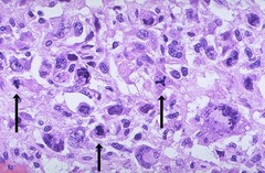 <p>mitotic figures</p>