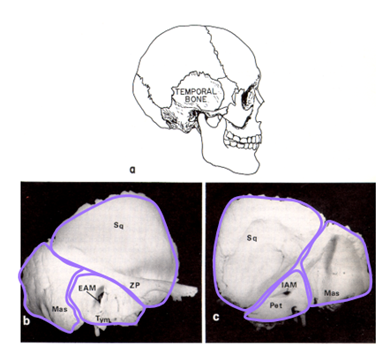 <p>what are the 4 different parts of the temporal bone?</p>