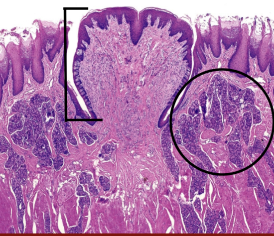 <p>What part of the tongue area is barred out?</p>