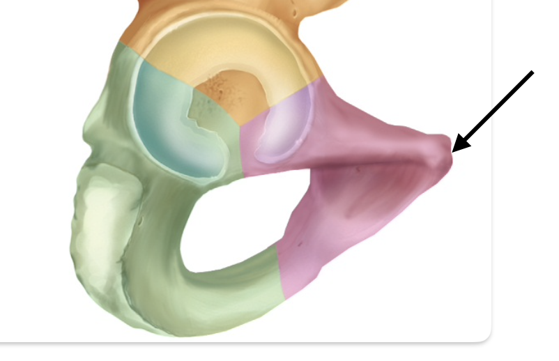 <p>Identify the bone/anatomical feature of the pelvis.</p>