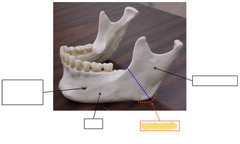 <p>Mandible</p>