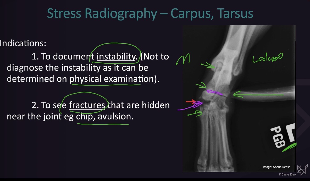 <ul><li><p>Document instability via radiographs</p></li><li><p>See fractures that are hidden near the joint (chip, avulsion)</p></li></ul><p></p>