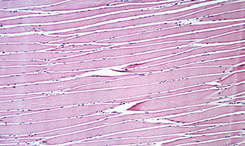 <ol><li><p>Sickle Cell Anemia</p></li><li><p>Atherosclerosis</p></li><li><p>Adenocarcinoma of Kidney</p></li><li><p>Osteogenic Sarcoma of Bone</p></li><li><p>Tattoo in Human Skin</p></li><li><p>Neurilemmoma</p></li><li><p>Anthracosis of the Lung</p></li><li><p>Basal Cell Carcinoma</p></li><li><p>Lung</p></li><li><p>Skeletal</p></li><li><p>Kidney</p></li><li><p>Neuron</p></li><li><p>Skin</p></li><li><p>Blood</p></li><li><p>Bone</p></li><li><p>Aorta</p></li></ol><p></p>