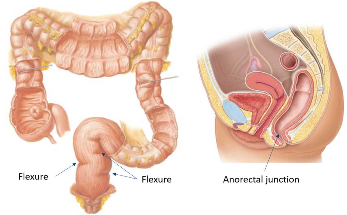 <ul><li><p>Begins at <strong>rectosigmoid junction</strong></p></li><li><p>Follows <em>convexity</em><strong><em> </em></strong>of <strong>sacrum</strong> &amp; finishes at <strong>tip of coccyx</strong> (→ <strong>@nal canal</strong>)</p></li><li><p>Change in <em>external</em> musculature for <strong>sigmoid colon</strong> to <strong>r3ctum</strong></p><ul><li><p><strong>Taeniae coli</strong> blending into <strong>broad</strong>, <strong>continuous</strong>, <strong>longitudinal</strong> bands</p></li></ul></li><li><p>Anterior view → 3 distinct <strong>flexures</strong></p></li></ul><p></p>