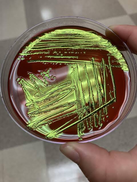 <p>Dark, blue-black colonies with a <strong>distinct metallic green sheen</strong></p><p></p><p>Vigorous lactose &amp; sucrose fermenter. Strong acid production causes dye precipitation.</p>