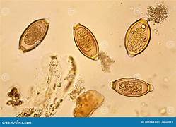 <p>Parasite or Artifact? Identify.</p>