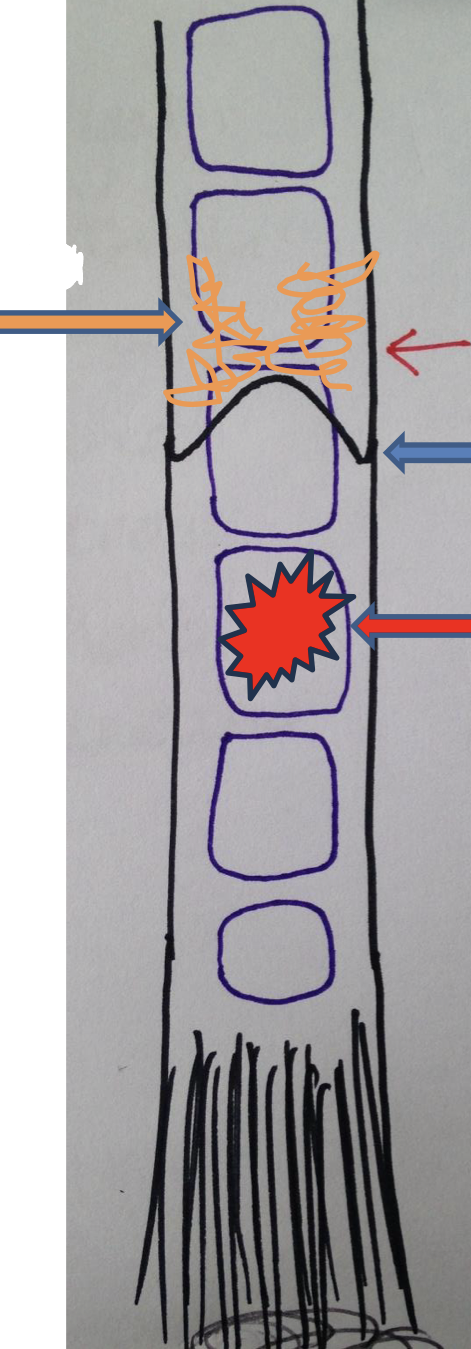 <p>What does the thick red arrow on bottom point to in the tail amputation?</p>